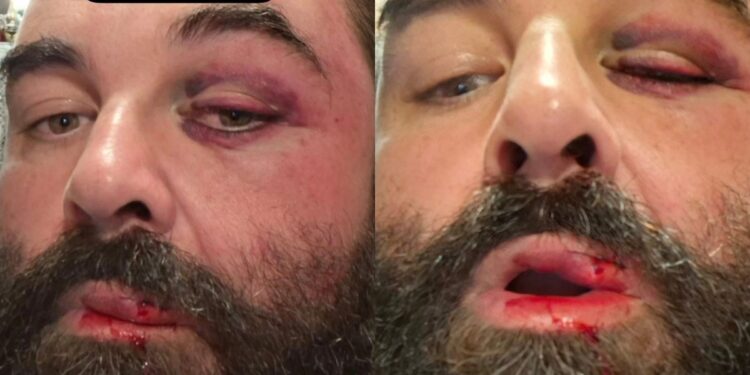 'Caí desacordado', diz homem que levou socos de guarda de folga ao reclamar de som alto em igreja de SC