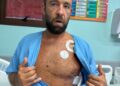 'Sucessão de milagres': quem é o brasileiro atingido no coração por peixe-espada na Costa Rica