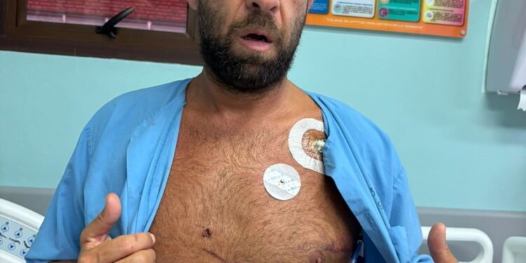 'Sucessão de milagres': quem é o brasileiro atingido no coração por peixe-espada na Costa Rica