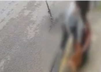Vídeo mostra desespero de jovem atacada por pitbull na rua em SC: 'Minha única reação foi gritar'